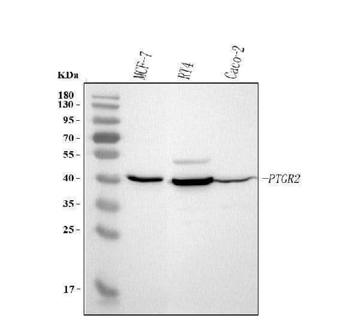 Anti-PTGR2 Antibody Picoband® Boster Bio
