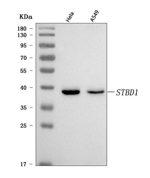 Anti-STBD1 Antibody Picoband® Boster Bio