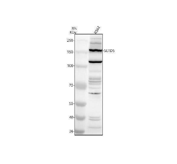 Anti-SETD5 Antibody Picoband® Boster Bio