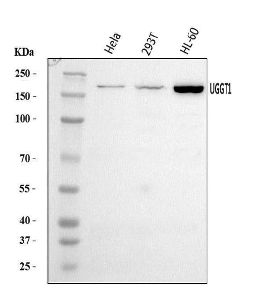 Anti-UGGT/UGT1/UGGT1 Antibody Picoband® Boster Bio