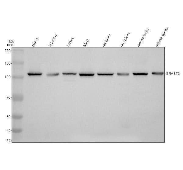 Anti-SFMBT2 Antibody Picoband® Boster Bio