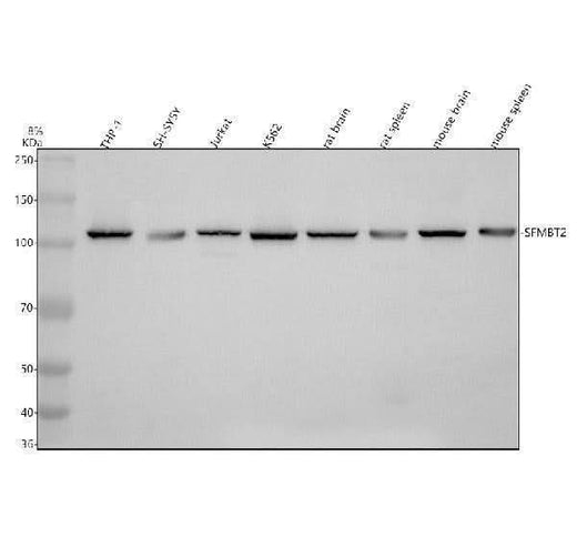 Anti-SFMBT2 Antibody Picoband® Boster Bio