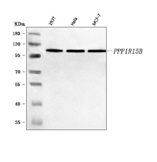 Anti-PPP1R15B Antibody Picoband® Boster Bio