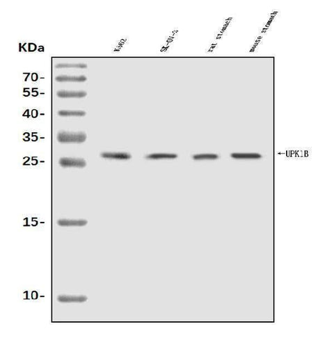 Anti-Uroplakin Ib/UPIb Antibody Picoband® Boster Bio