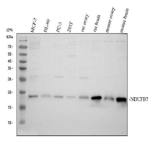 Anti-NDUFB7 Antibody Picoband® Boster Bio