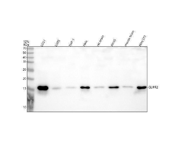 Anti-GLIPR2 Antibody Picoband® Boster Bio