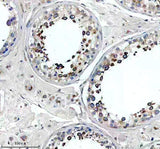 Anti-SLC2A11 Antibody Boster Bio