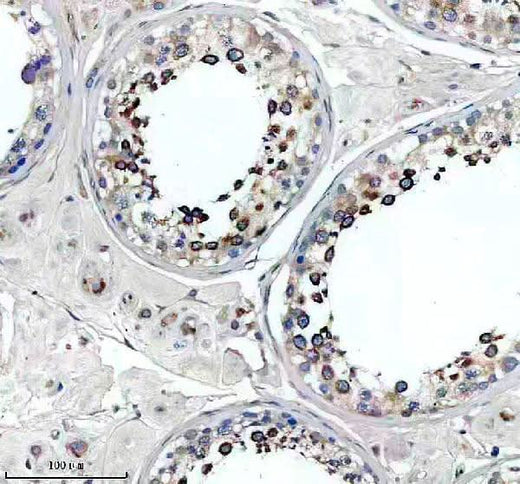 Anti-SLC2A11 Antibody Boster Bio