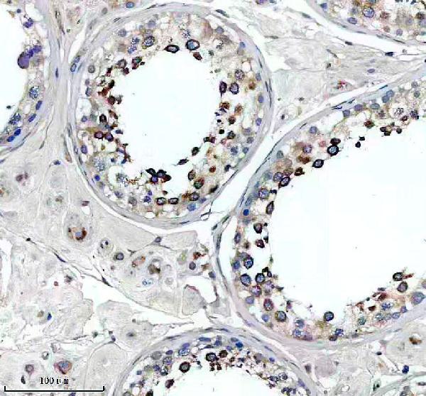 Anti-SLC2A11 Antibody Boster Bio