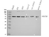 Anti-MGAT4B Antibody Picoband® Boster Bio