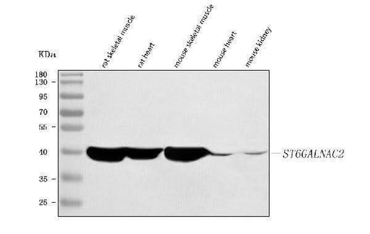 Anti-ST6GALNAC2 Antibody Picoband® Boster Bio