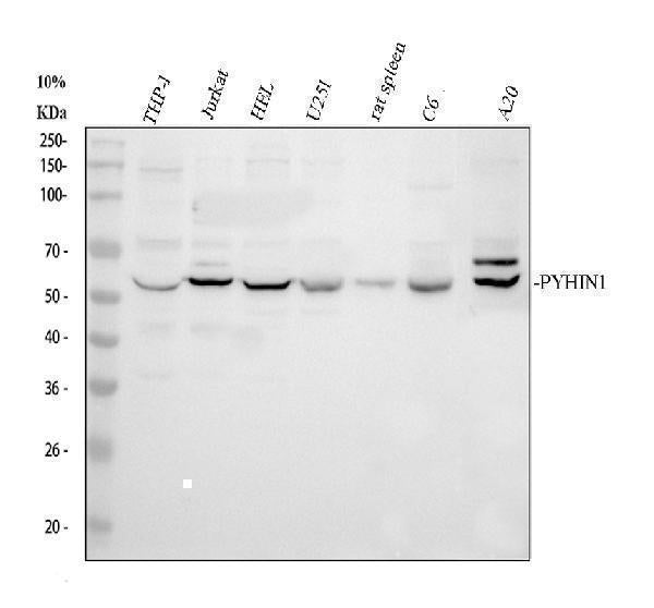Anti-PYHIN1 Antibody Picoband® Boster Bio