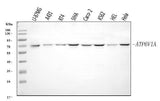 Anti-ATP6V1A Antibody Picoband® Boster Bio