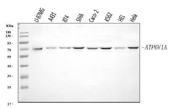 Anti-ATP6V1A Antibody Picoband® Boster Bio