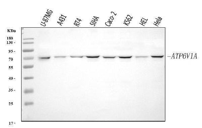 Anti-ATP6V1A Antibody Picoband® Boster Bio