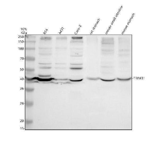 Anti-TRIM31 Antibody Picoband® Boster Bio