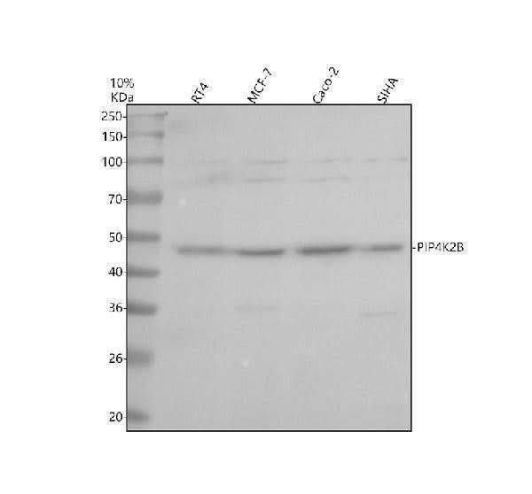Anti-PIP4K2C Antibody Picoband® Boster Bio