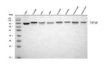 Anti-TOP3B Antibody Picoband® Boster Bio