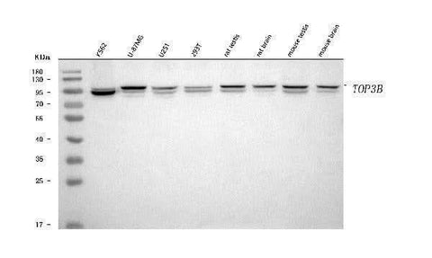 Anti-TOP3B Antibody Picoband® Boster Bio