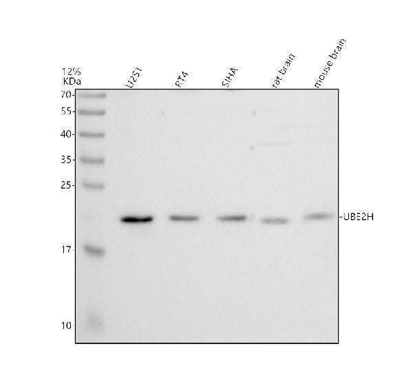 Anti-UBE2H Antibody Picoband® Boster Bio