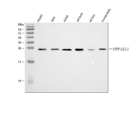 Anti-PPP1R11 Antibody Picoband® Boster Bio