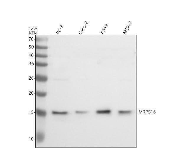 Anti-MRPS16 Antibody Picoband® Boster Bio