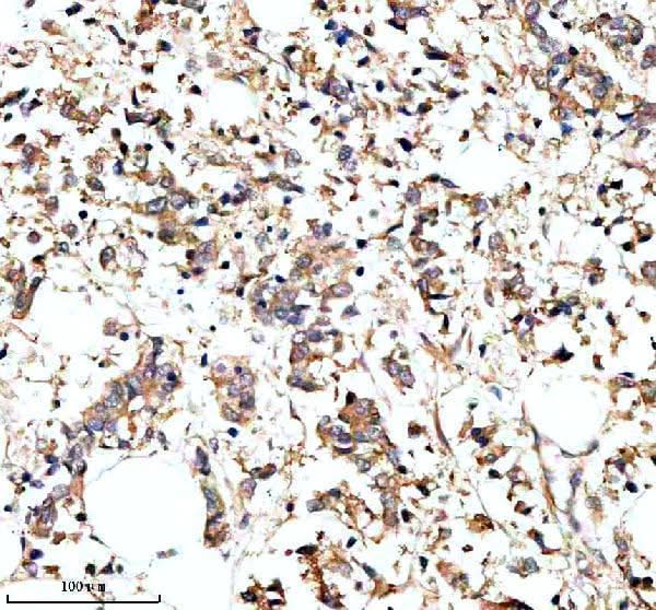 Anti-PARP16 Antibody Boster Bio