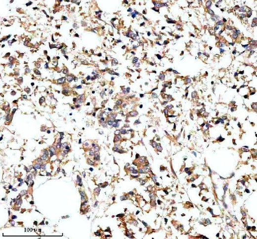 Anti-PARP16 Antibody Boster Bio