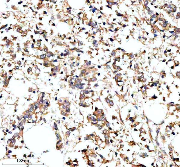 Anti-PARP16 Antibody Boster Bio
