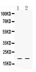 Anti-Alpha Defensin 1/DEFA1 Antibody Picoband® Boster Bio