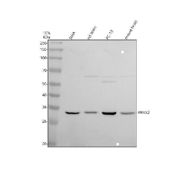 Anti-PRRX2 Antibody Picoband® Boster Bio