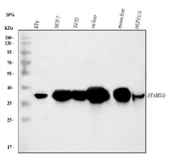 Anti-PCTP-L/STARD10 Antibody Picoband® Boster Bio
