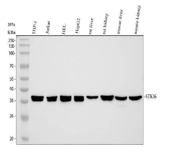Anti-STK16 Antibody Picoband® Boster Bio
