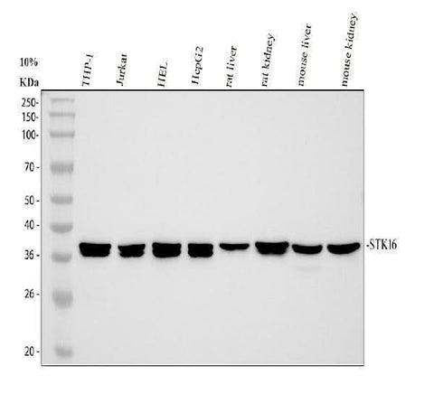 Anti-STK16 Antibody Picoband® Boster Bio