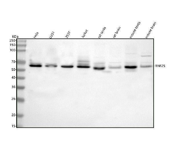 Anti-RNF25 Antibody Picoband® Boster Bio