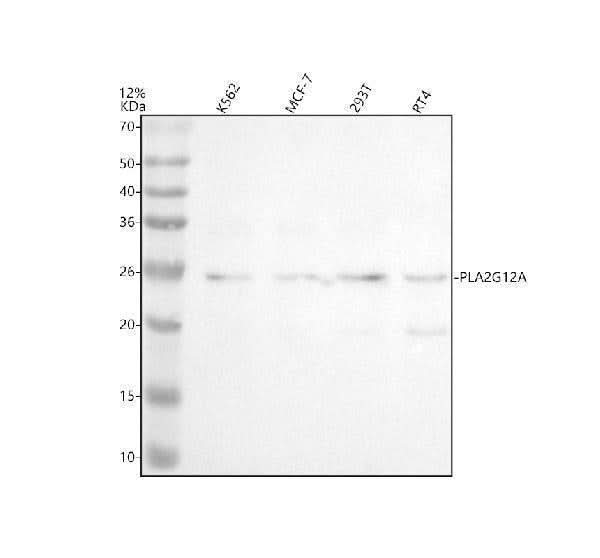 Anti-PLA2G12A Antibody Picoband® Boster Bio