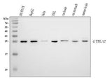 Anti-LYPLA2 Antibody Picoband® Boster Bio