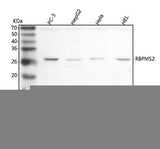 Anti-RBPMS2 Antibody Picoband® Boster Bio