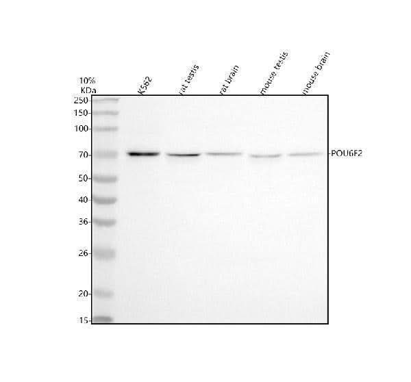 Anti-POU6F2 Antibody Picoband® Boster Bio