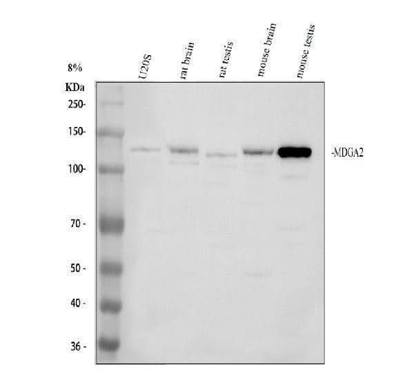 Anti-MDGA2 Antibody Picoband® Boster Bio