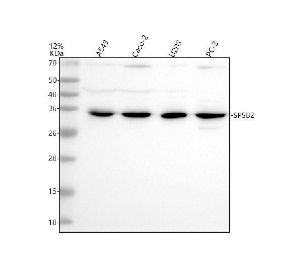 Anti-SPSB2 Antibody Picoband® Boster Bio