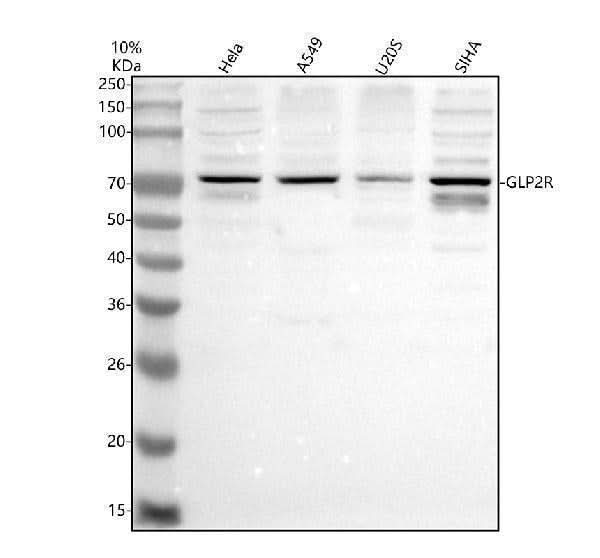 Anti-GLP2R Antibody Picoband® Boster Bio
