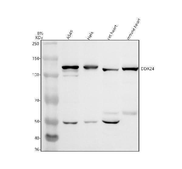 Anti-DDX24 Antibody Picoband® Boster Bio