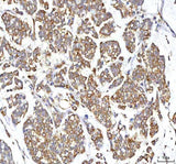 Anti-GOLGA7 Antibody Boster Bio