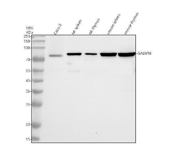 Anti-GALNT6 Antibody Picoband® Boster Bio