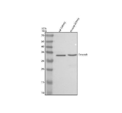 Anti-TMEM9 Antibody Picoband® Boster Bio