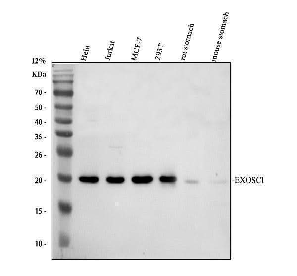 Anti-EXOSC1 Antibody Picoband® Boster Bio
