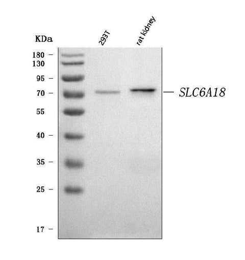 Anti-SLC6A18 Antibody Picoband® Boster Bio