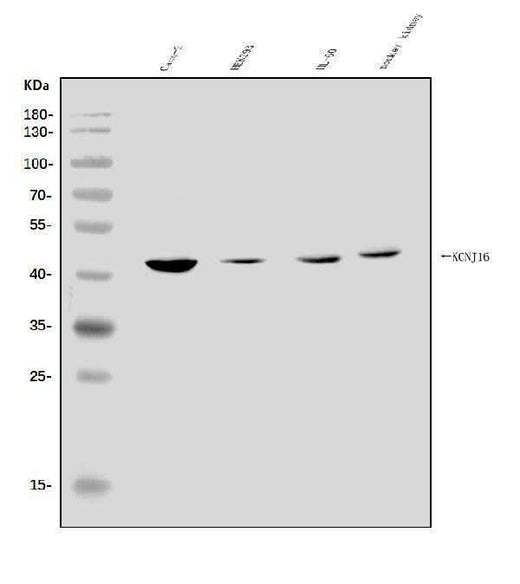 Anti-KCNJ16 Antibody Picoband® Boster Bio