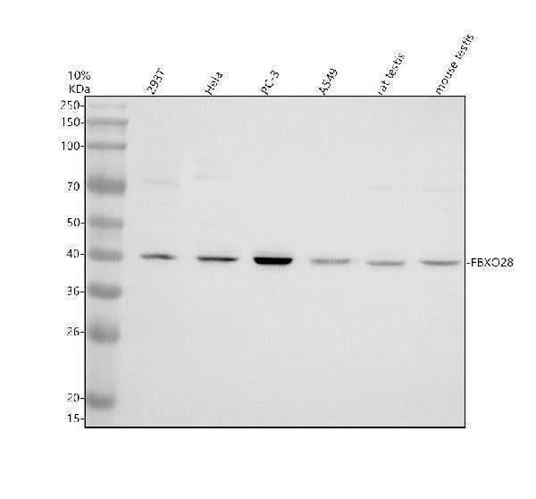 Anti-FBXO28 Antibody Picoband® Boster Bio
